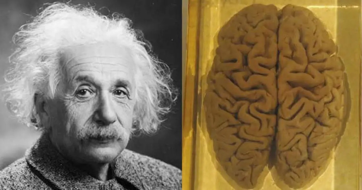 مغز آلبرت اینشتین در شیشه / چه تفاوتی با مغز دیگران مشاهده شد؟ + عکس