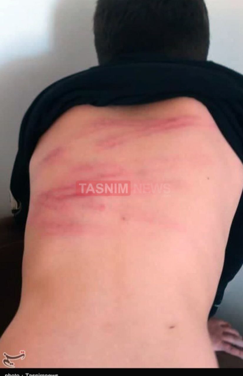 ضرب‌وشتم وحشتناک دانش‌آموزان توسط معلم در سنندج/ یک دانش‌آموز در بیمارستان بستری شد/ آموزش وپرورش: معلم خاطی مشکل روانی دارد/ حکم اخراجش از شهرستان صادر می‌شود + تصاویر