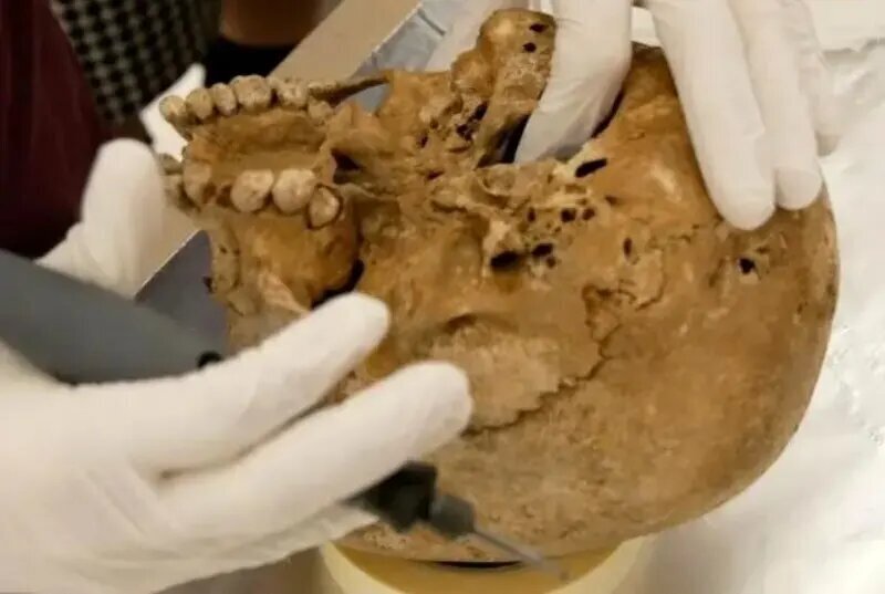 این اسکلت ۱۲ هزار ساله یک بیماری ژنتیکی نادر دارد! + عکس این اسکلت ۱۲ هزار ساله یک بیماری ژنتیکی نادر دارد! + عکس