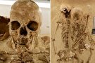 این اسکلت ۱۲ هزار ساله یک بیماری ژنتیکی نادر دارد! + عکس