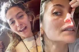 دختر مایکل جکسون تیغه سوراخ‌شده بینی‌اش را نشان داد: «مواد مصرف نکنید!» + عکس