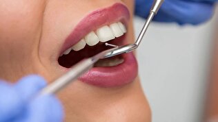 انقلابی در دندان‌پزشکی؛ یک ژل پروتئینی جدید مینای دندان را ترمیم و بازسازی می‌کند