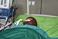 اسیدپاشی هولناک روی پدر و دختر / انگیزه همسایه اسیدپاش چه بود؟